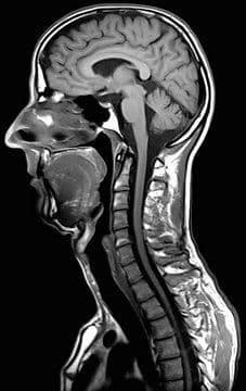 Head & Neck MRI Image